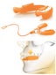Shock Doctor Gravity 2 STC Lower Mouthguard